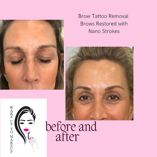 Explore tattoo ideas for your kids, creative tattoo ideas in Naples, available at Laser Tattoo Removal Services