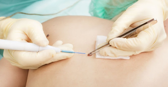 Dr Mohamed F. Sacoor - Dr Mohamed F. Sacoor