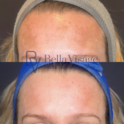 Explore black and white tattoo ideas, creative tattoo ideas in Lakeland, available at Bella Visge Medical & Aesthetic Rejuvenation