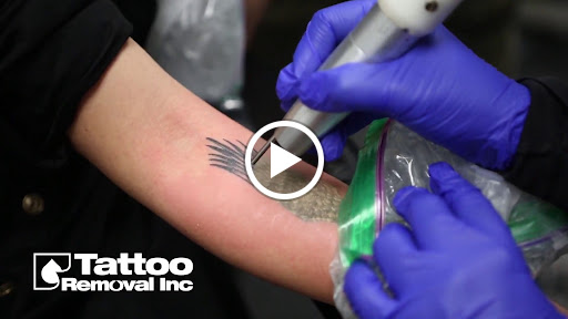 Explore unique tattoo ideas for females, creative tattoo ideas in South Gate, available at Tattoo Removal Inc