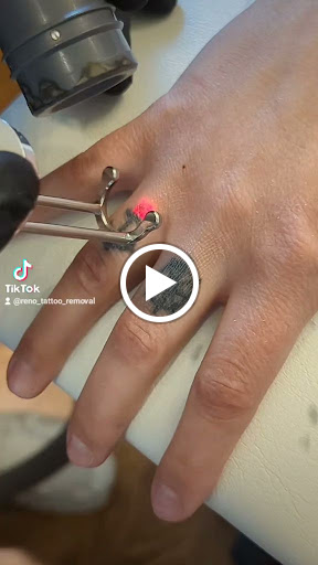 Explore tattoo ideas for mechanics, creative tattoo ideas in Reno, available at Reno Tattoo Removal