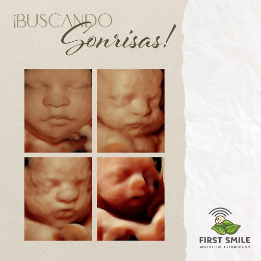 First Smile 4D/HD Live Ultrasound