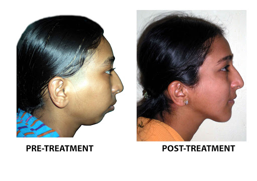 Dr. Pavankumar Vibhute Orthodontic & Dental Clinic