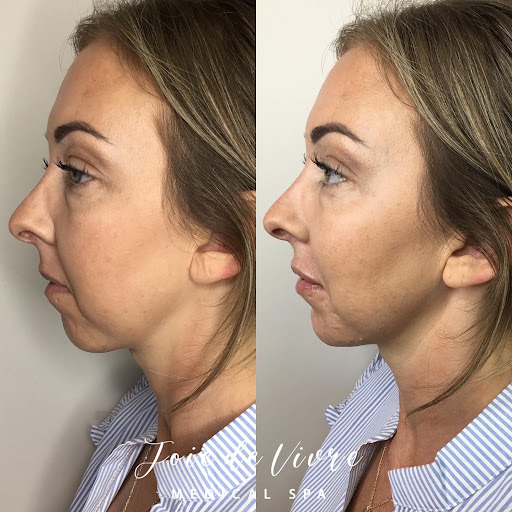 Explore virgin mary tattoo ideas, creative tattoo ideas in Canton, available at JDV Med Spa