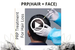 Hair Transplant And Skin Laser Extent Clinic image