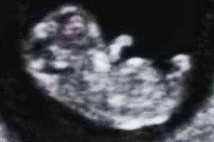 Sneeky Peek 4D baby scan image