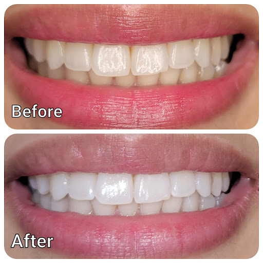 Smile Bright Teeth Whitening LLC