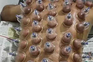 Hijama cupping therapy center image