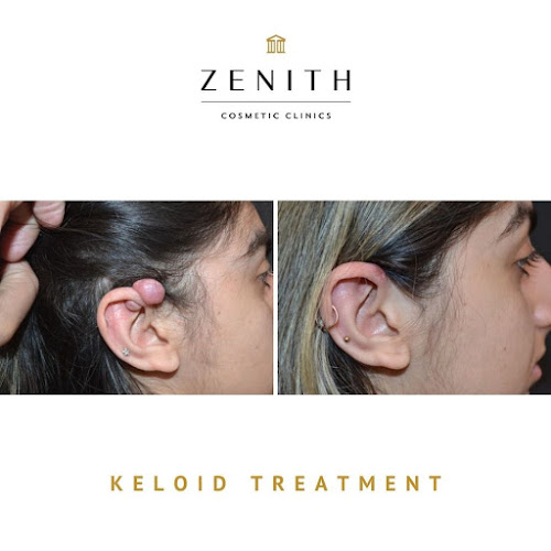 Comments and reviews of Zenith Cosmetic Clinics London