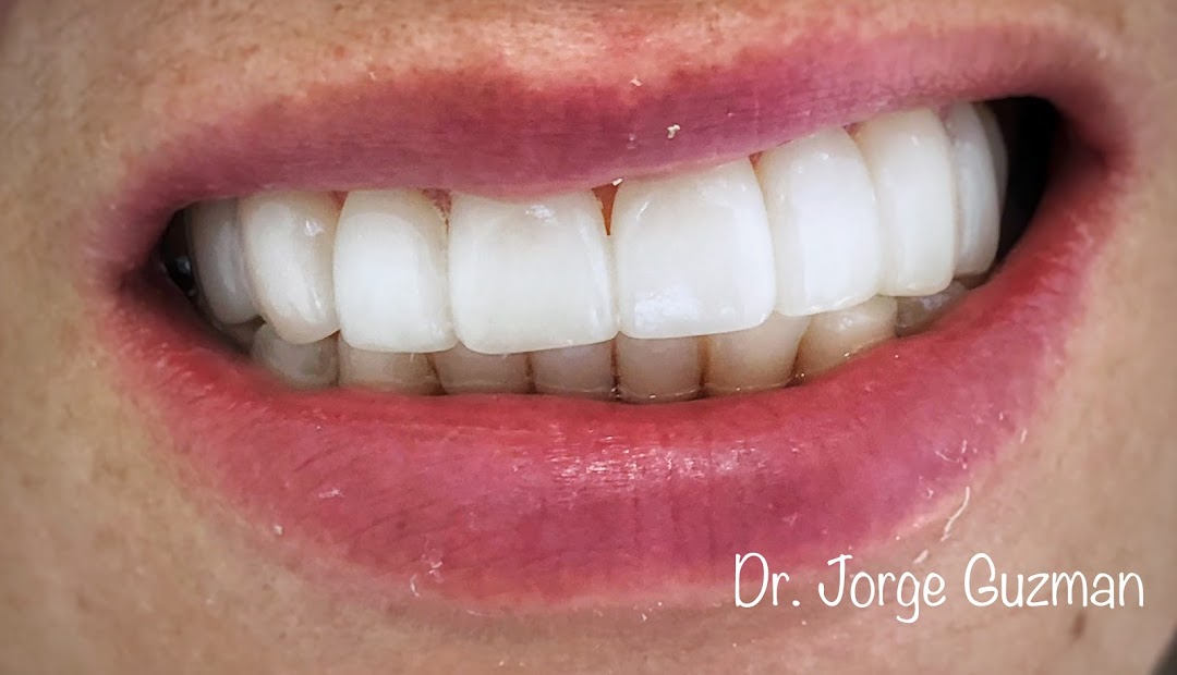 Unidad Ontológica Jorge Guzman Estetica dental