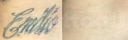 Find mama tattoo ideas for your next unique tattoo in Vienna at Removery Tattoo Removal & Fading