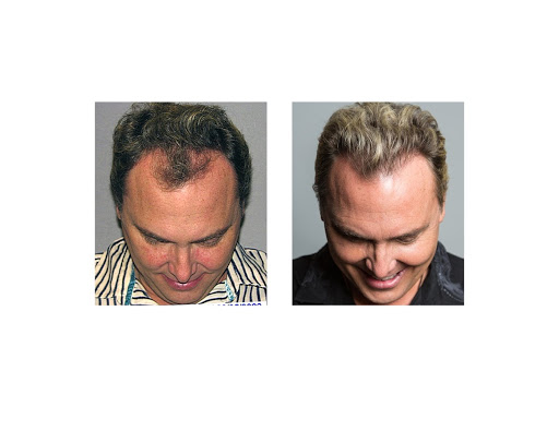 Hair Transplantation Clinic «Bosley Medical - Kansas City», reviews and photos, 460 Nichols Rd #350, Kansas City, MO 64112, USA