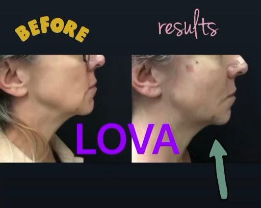 Explore knot tattoo ideas, creative tattoo ideas in Lake Oswego, available at Lake Oswego Vein and Aesthetic LOVA