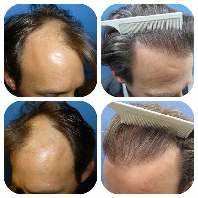 Meshkin Medical - Cosmetic Hair Restoration and Hair Transplant Clinic