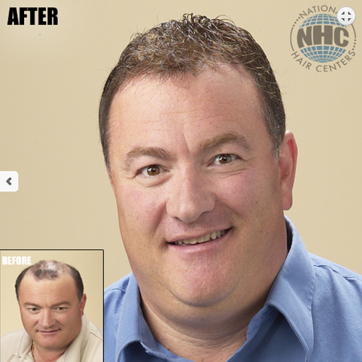 Hair Replacement Service «National Hair Centers», reviews and photos, 5828 N 7th St, Phoenix, AZ 85014, USA