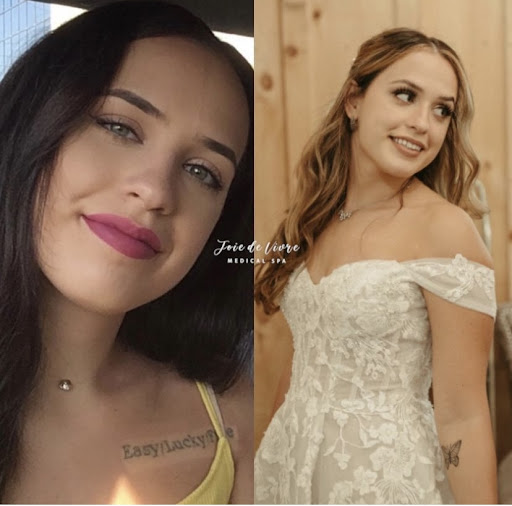 Explore band tattoo ideas, creative tattoo ideas in Canton, available at JDV Med Spa