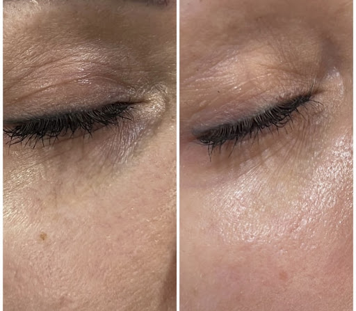 Medical Spa «Lavender Med Spa», reviews and photos, 3675 Crestwood Pkwy #400, Duluth, GA 30096, USA