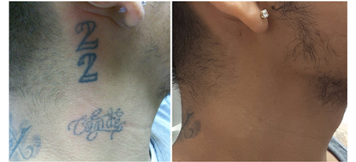 Explore bartender tattoo ideas, creative tattoo ideas in Saint Paul, available at Removery Tattoo Removal & Fading