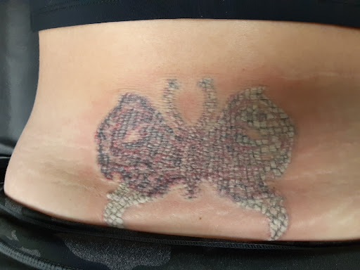 Explore rock and roll tattoo ideas, creative tattoo ideas in Saint Paul, available at Fearless Tattoo Removal