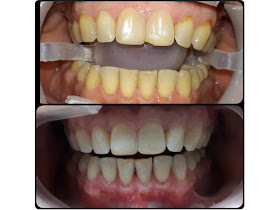 clinica dental odontopana