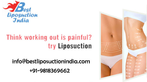 Liposuction in Delhi : Best Vaser Liposuction Cost in Delhi India