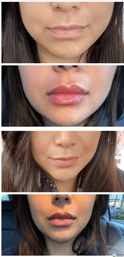 Medical Spa «Lavender Med Spa», reviews and photos, 3675 Crestwood Pkwy #400, Duluth, GA 30096, USA