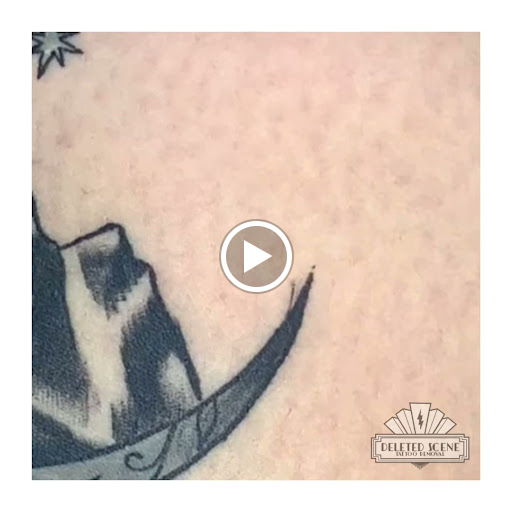 Find best friend tattoo ideas for guys for your next unique tattoo in Hatboro at Deleted Scene Tattoo Removal