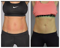 New You Body Sculpting - Photo 9 - Car repair in Hendersonville, TN, Nashville