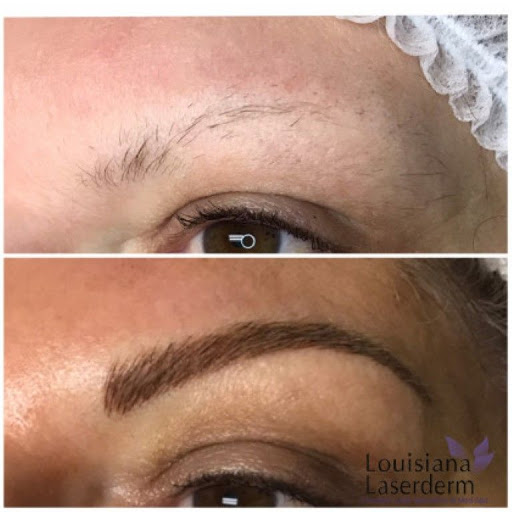 Explore tattoo ideas ribs guys, creative tattoo ideas in Baton Rouge, available at Louisiana Laserderm