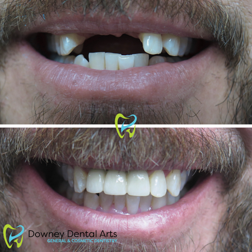 Downey Dental Arts image