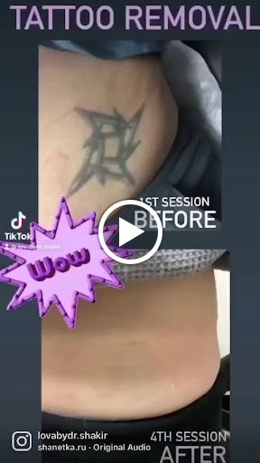 Explore nautical sleeve tattoo ideas, creative tattoo ideas in Lake Oswego, available at Lake Oswego Vein and Aesthetic LOVA