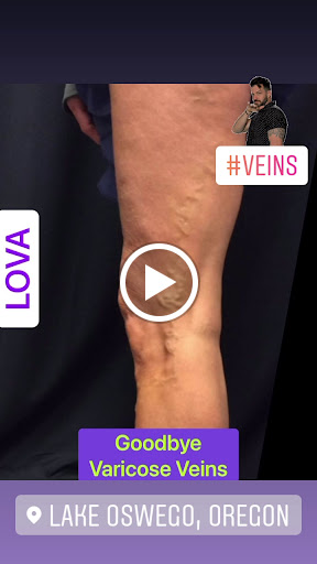 Explore mars attacks tattoo ideas, creative tattoo ideas in Lake Oswego, available at Lake Oswego Vein and Aesthetic LOVA