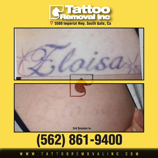 Explore family names tattoo ideas for guys, creative tattoo ideas in South Gate, available at Tattoo Removal Inc