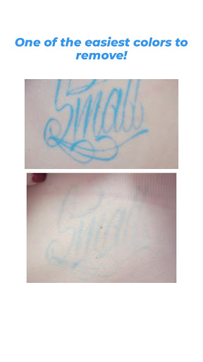 Explore one piece tattoos ideas, creative tattoo ideas in Chino, available at SoCal Body Institute