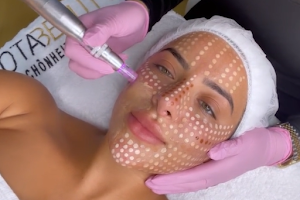 Beauty Aura Brows Skin & Laser image