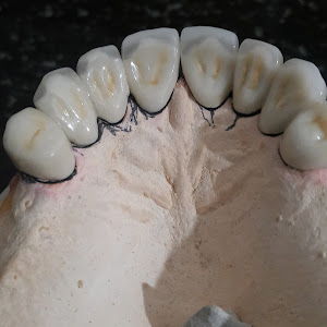 Bala Ji Dental Lab photo