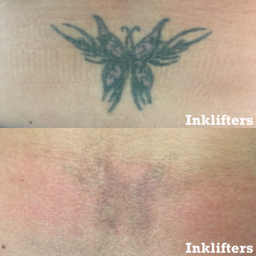 Explore tattoo ideas for pisces, creative tattoo ideas in Pleasant Grove, available at Inklifters Tattoo Removal