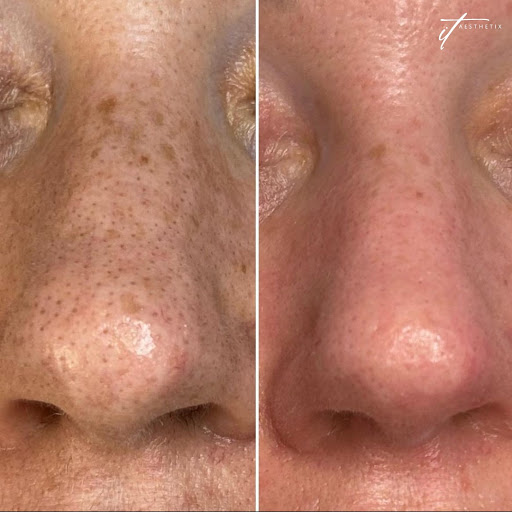 Explore fine line tattoo ideas for females, creative tattoo ideas in East Brunswick, available at It Aesthetix