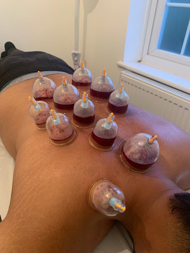 The Cupping Company