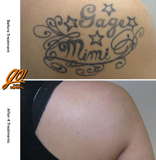 Explore no fear tattoo ideas, creative tattoo ideas in Allentown, available at Removery Tattoo Removal & Fading