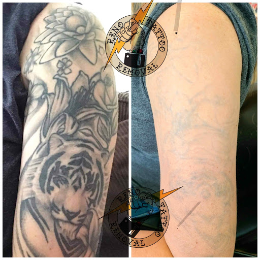 Find tattoo ideas gay for your next unique tattoo in Reno at Reno Tattoo Removal