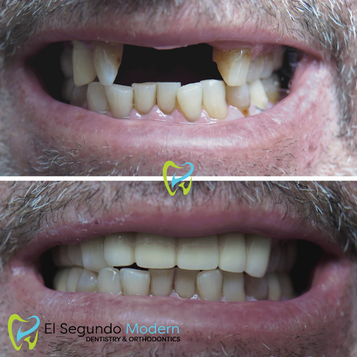 El Segundo Modern Dentistry image