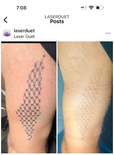 Explore duck hunting tattoo ideas, creative tattoo ideas in Dearborn, available at Laser Duet Med Spa