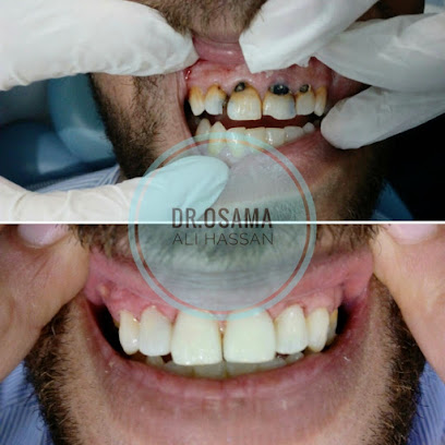 د. أسامة علي حسن - Dr. Osama Ali Hassan dental clinic