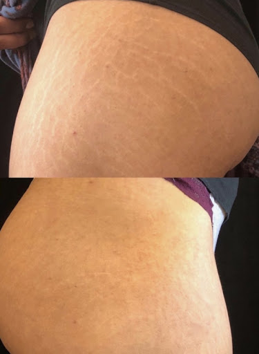 Explore athletic tattoo ideas, creative tattoo ideas in Conroe, available at Institute 28