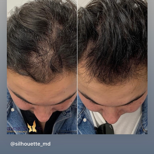 Explore hunting tattoo ideas, creative tattoo ideas in Summit, available at Ethos Aesthetics and Wellness, Laser Hair Removal and Med Spa