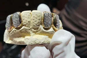 Atlanta Custom Gold Grills image