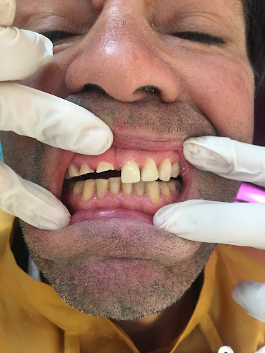 Clinica Dental Cabrero Dr.Gaston Reyes Pilser