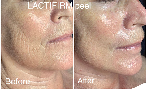 Simply Skin at Tamzyn - Simply Skin at Tamzyn