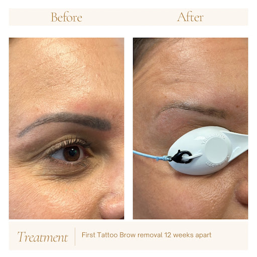 Explore luna lovegood tattoo ideas, creative tattoo ideas in Tampa, available at Luminous Skin and Laser